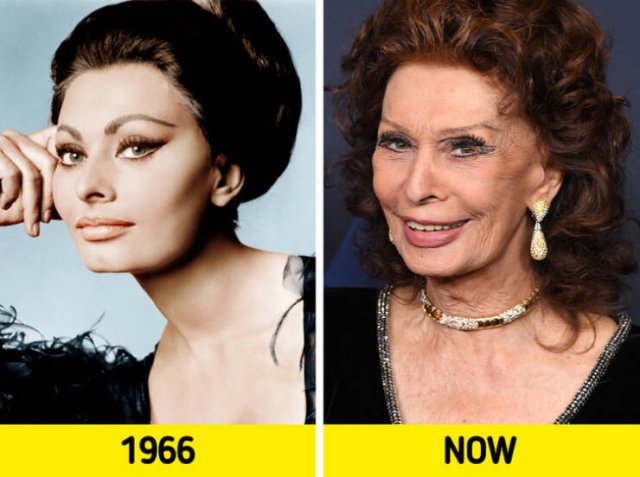 Celebrities Then And Now (16 pics) Celebrities Then And Now (16 pics)