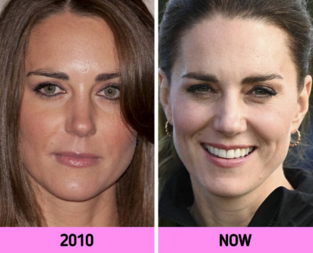 How Faces Of Celebrities Changed Over The Years (11 pics)