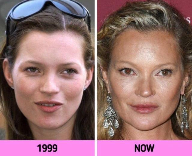 How Faces Of Celebrities Changed Over The Years (11 pics)