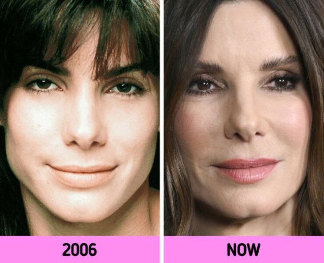 How Faces Of Celebrities Changed Over The Years (11 pics)