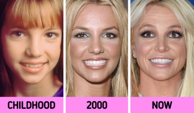 How Faces Of Celebrities Changed Over The Years (11 pics)