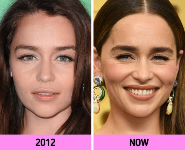 How Faces Of Celebrities Changed Over The Years (11 pics)