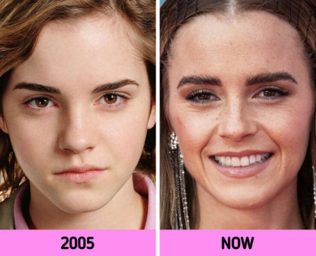 How Faces Of Celebrities Changed Over The Years (11 pics)