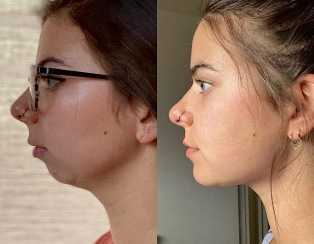 People Who Radically Changed Themselves (18 pics)