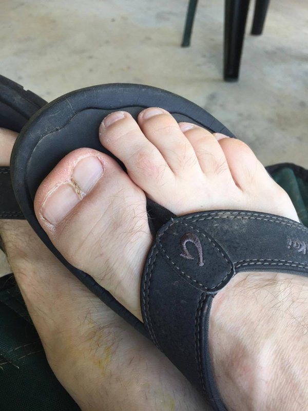 People With Unusual Genetics (15 pics)