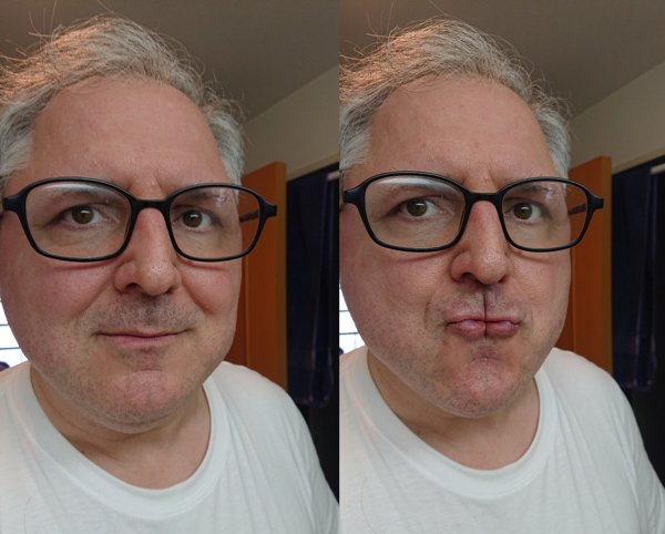 People With Unusual Genetics (15 pics)