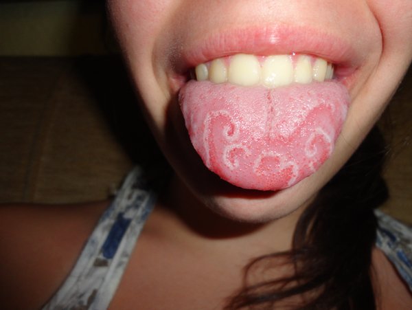 People With Unusual Genetics (15 pics)
