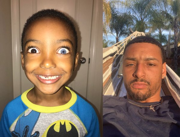 People With Unusual Genetics (15 pics)