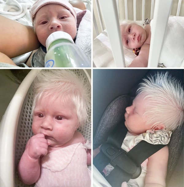 People With Unusual Genetics (15 pics)