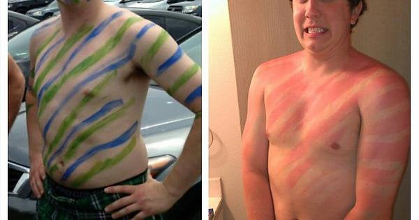 Unsuccessful Tan (30 pics)