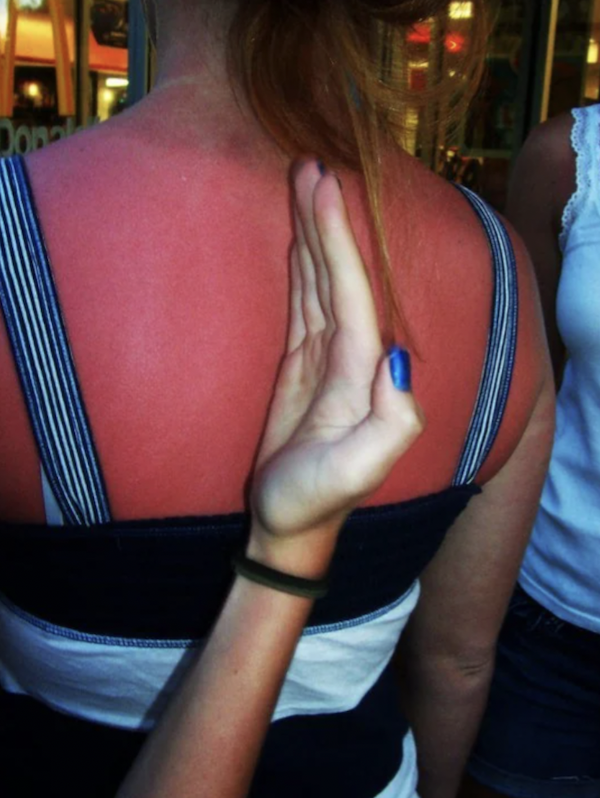 Unsuccessful Tan (30 pics)