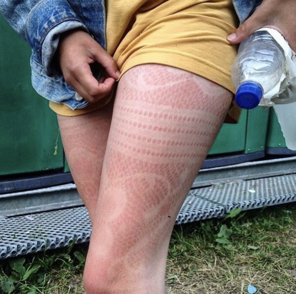 Unsuccessful Tan (30 pics)