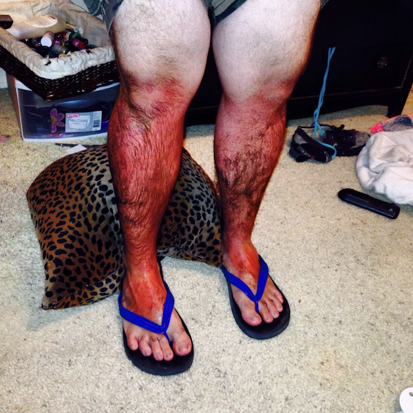 Unsuccessful Tan (30 pics)