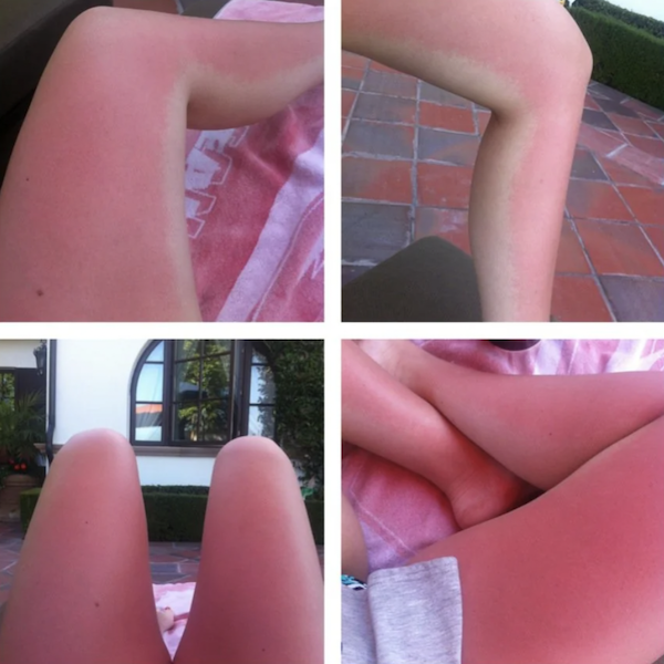 Unsuccessful Tan (30 pics)