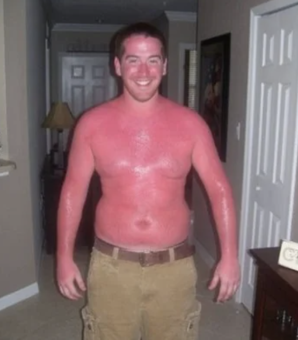 Unsuccessful Tan (30 pics)