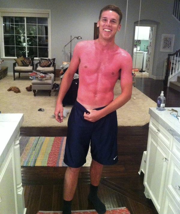 Unsuccessful Tan (30 pics)