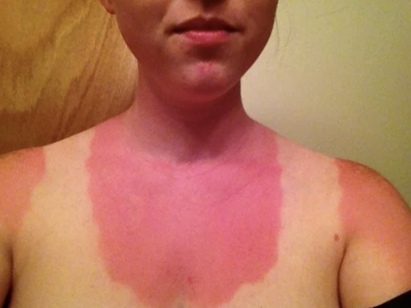 Unsuccessful Tan (30 pics)