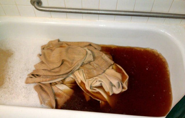 The Scary Consequences Of Smoking (25 pics)
