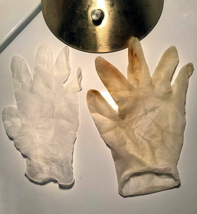 The Scary Consequences Of Smoking (25 pics)
