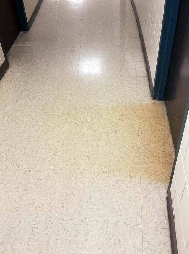 The Scary Consequences Of Smoking (25 pics)