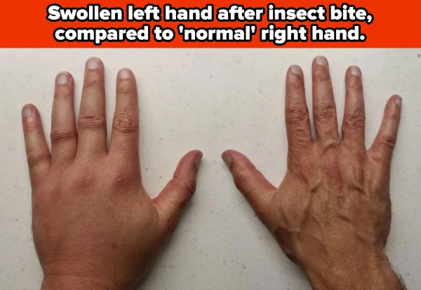 People With Weird Body Features (19 pics)