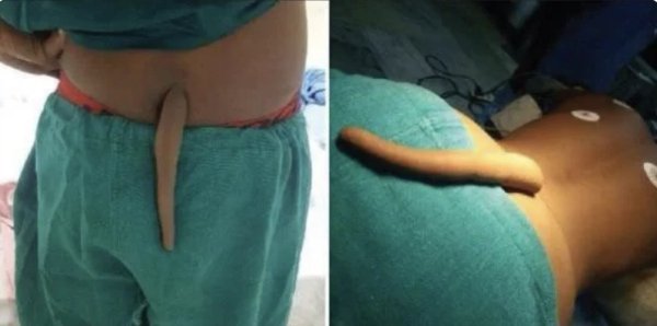 People With Weird Body Features (19 pics)