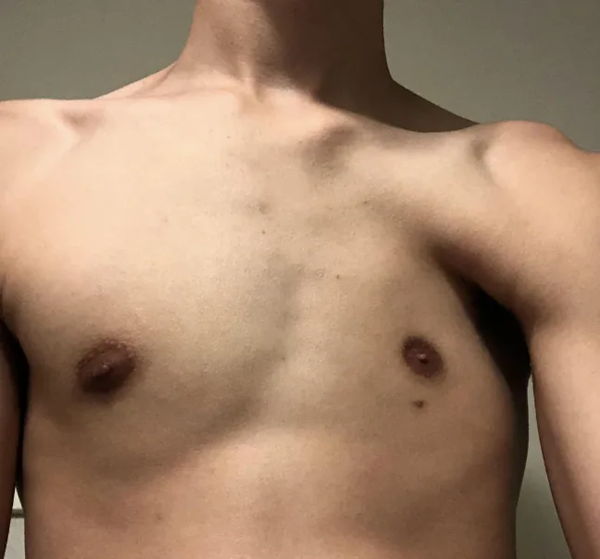 People With Weird Body Features (19 pics)