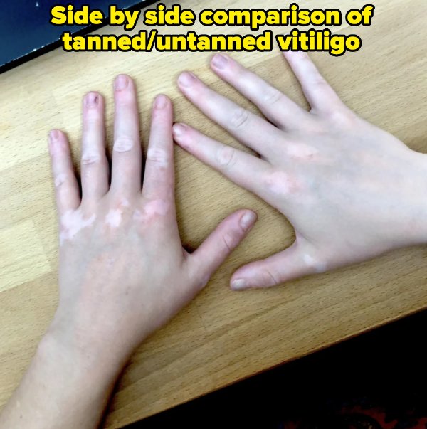 People With Weird Body Features (19 pics)