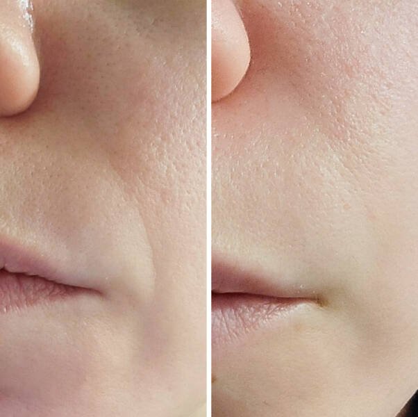 Cool ''Before And After'' Photos (15 pics)
