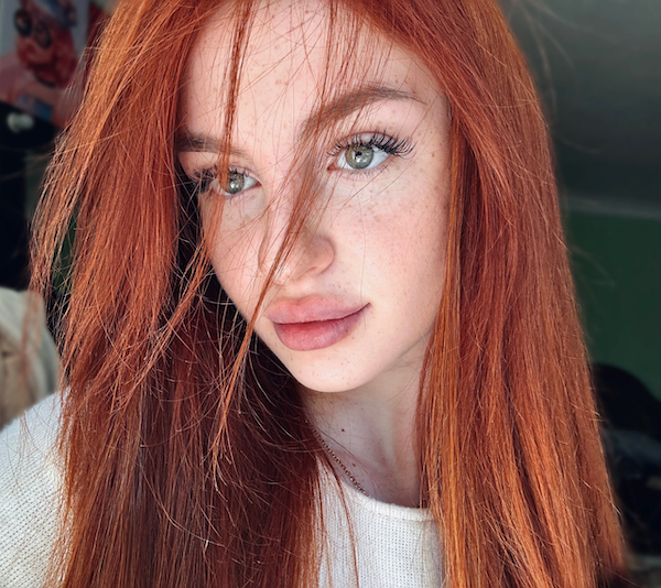 Girls With Freckles (31 pics)