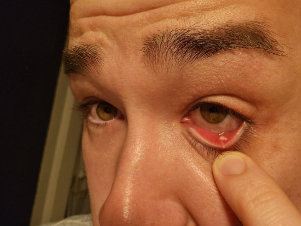 Bad Days Happen (23 pics)