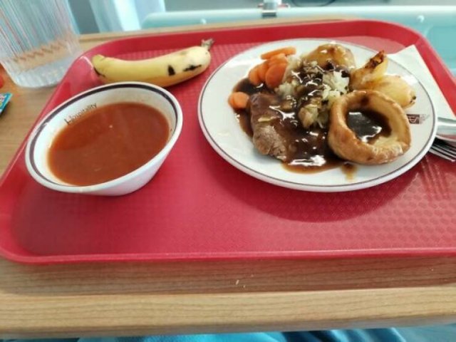 Food In Different Hospitals (20 pics)