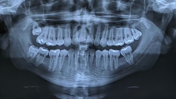 Fascinating Medical Photos (25 pics)