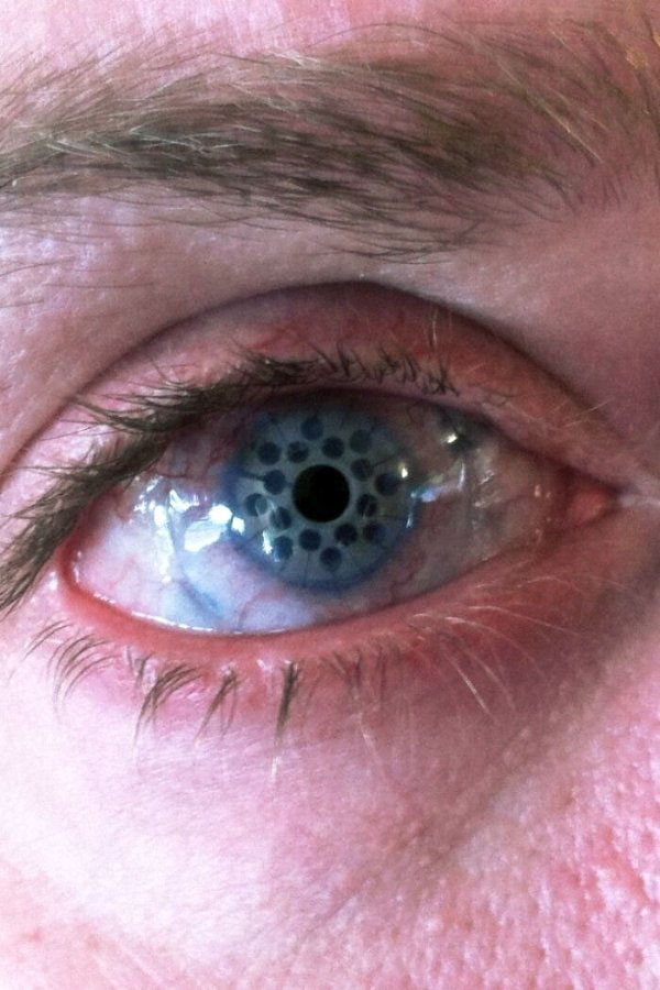 Fascinating Medical Photos (25 pics)