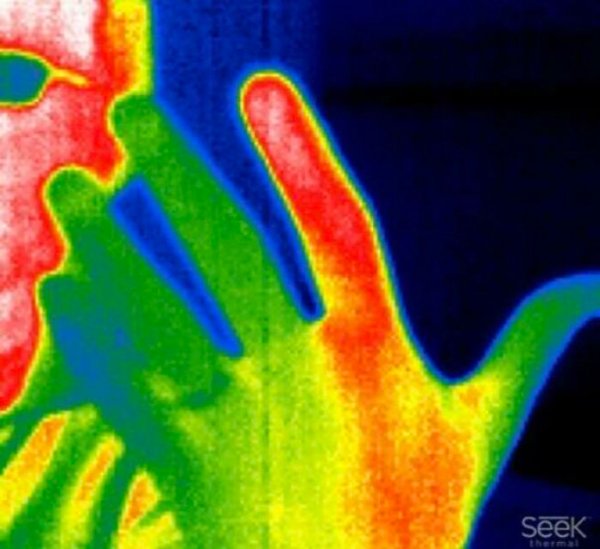 Fascinating Medical Photos (25 pics)