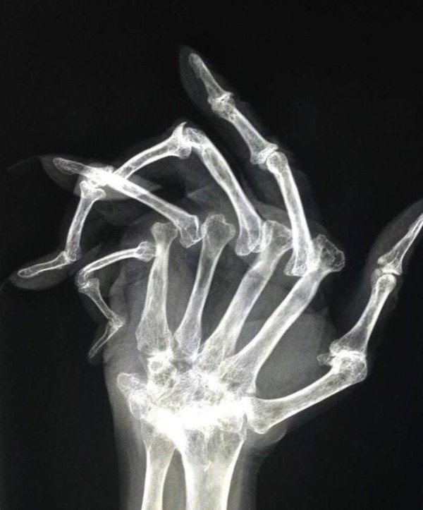 Fascinating Medical Photos (25 pics)