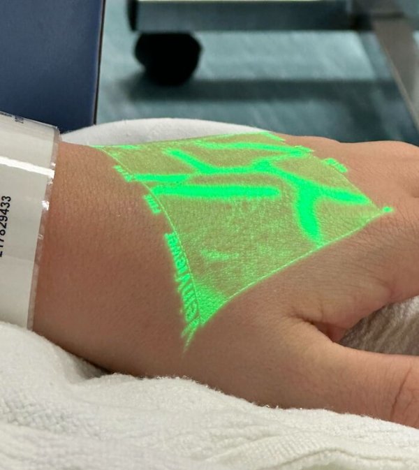 Fascinating Medical Photos (25 pics)