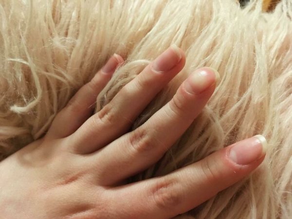 People With Unique Features (27 pics)