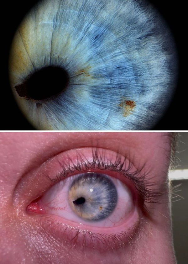 People With Unique Features (27 pics)