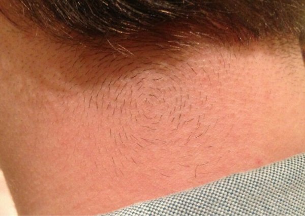 People With Unique Features (27 pics)