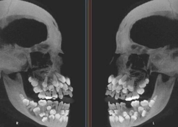 People With Unique Features (27 pics)