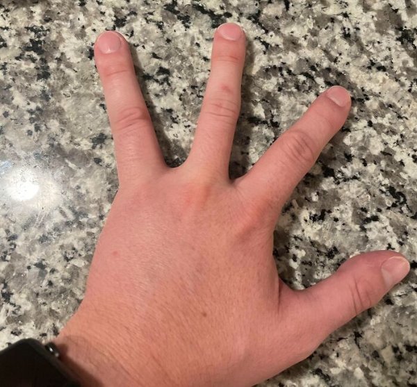 People With Unique Features (27 pics)