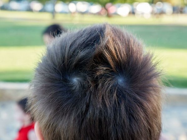 People With Unique Features (27 pics)