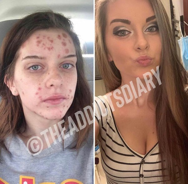 People Who Changed Their Lives (24 pics)