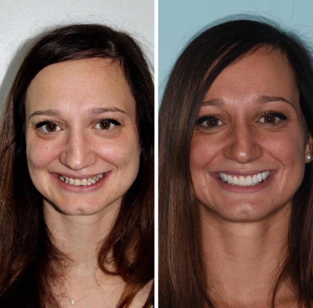 Interesting Comparisons (27 pics)