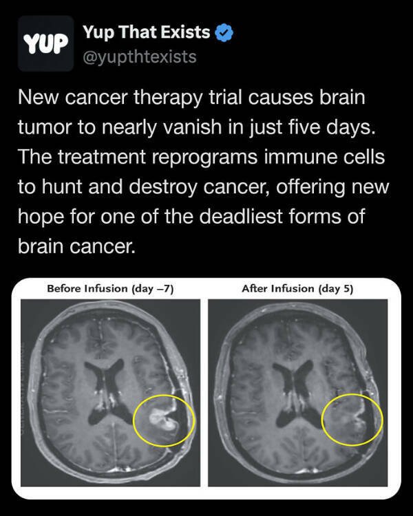 Interesting Facts (25 pics)
