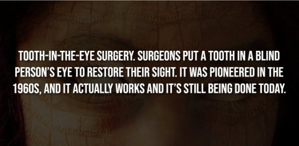 Creepy Facts (15 pics)