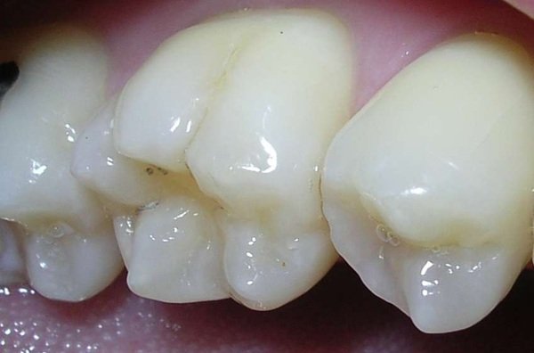 Interesting Facts (17 pics)