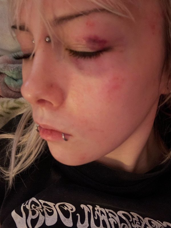 Bad Days Happen (22 pics)