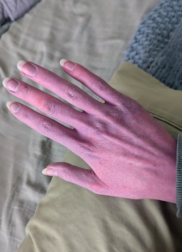 Bad Days Happen (23 pics)